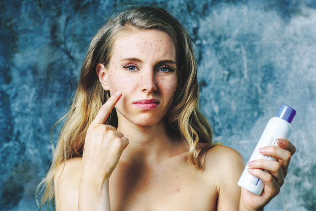 Контактне алергије: Изазива их кућна хемија, козметика, никл...